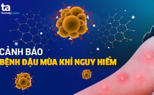 Tăng cường công tác phòng, chống bệnh Đậu mùa khỉ