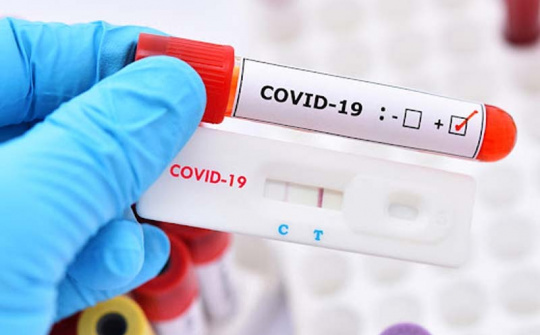 Giảm thời gian ủ bệnh làm căn cứ công bố hết dịch COVID-19
