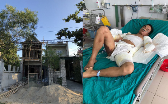 THANH HÓA: Hai anh em sinh đôi bị điện giật tàn phế