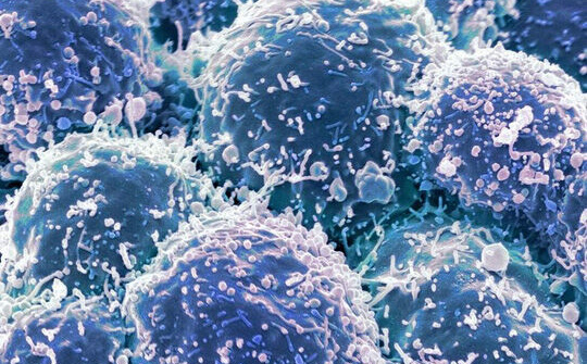 Dùng virus để điều trị ung thư