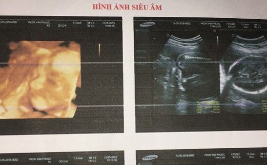 Bộ Y tế yêu cầu xác minh trường hợp tử vong do phá thai tại Ninh Thuận