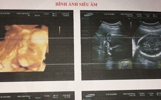 Bộ Y tế yêu cầu xác minh trường hợp tử vong do phá thai tại Ninh Thuận