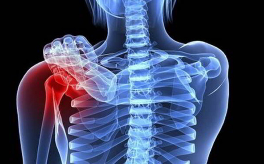 Ung thư xương và những điều cần biết