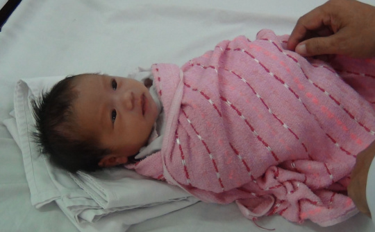 Bé gái 15 ngày tuổi suýt nhiễm trùng huyết do xỏ khuyên tai