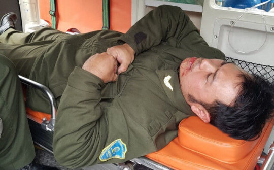 Xử lý nghiêm nhóm đối tượng hành hung nhân viên an ninh sân bay Nội Bài