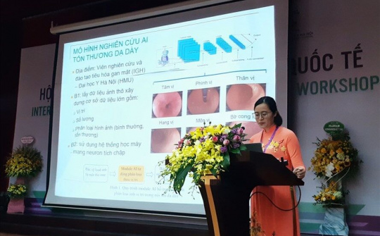 Trí tuệ nhân tạo giúp bác sĩ nội soi phát hiện tổn thương đường tiêu hóa