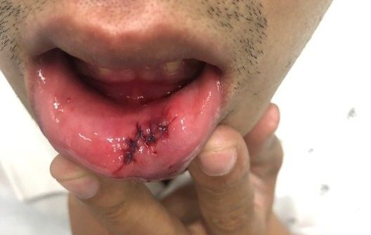 Đà Nẵng: Một phóng viên bị côn đồ hành hung khi đang tác nghiệp