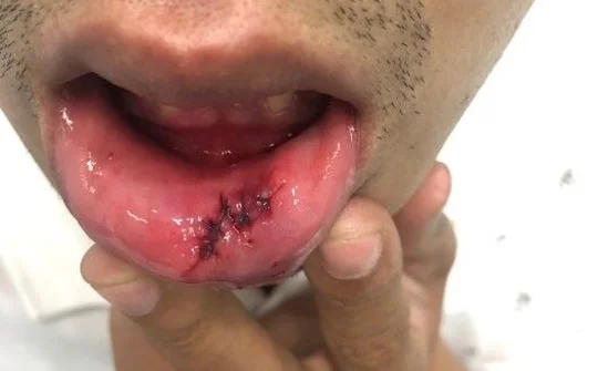 Đà Nẵng: Một phóng viên bị côn đồ hành hung khi đang tác nghiệp