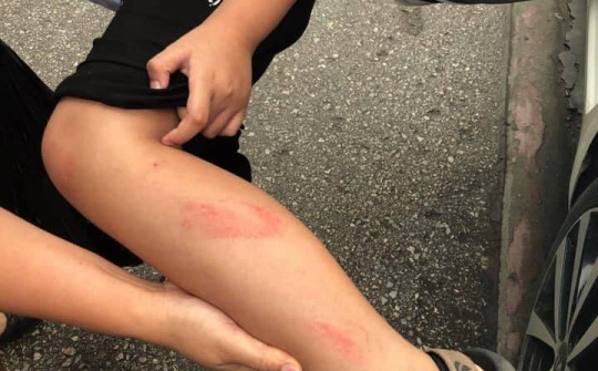 Hải Phòng: Đình chỉ công tác đối với giáo viên đánh học sinh trong giờ kiểm tra học kỳ