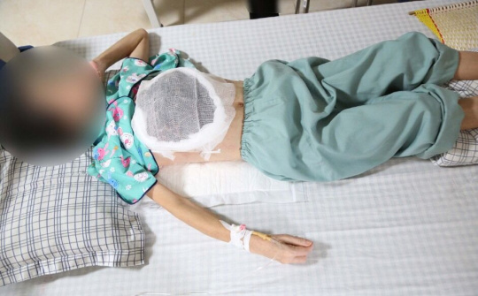 Chữa ung thư bằng thuốc của "lang băm" gây hệ lụy khôn lường