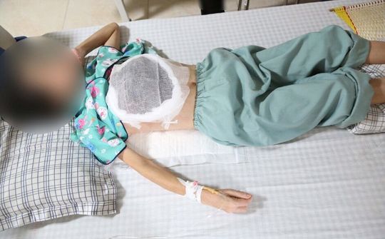 Chữa ung thư bằng thuốc của "lang băm" gây hệ lụy khôn lường