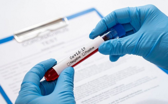 Cho phép đặt hàng cung cấp dịch vụ xét nghiệm SARS-CoV-2