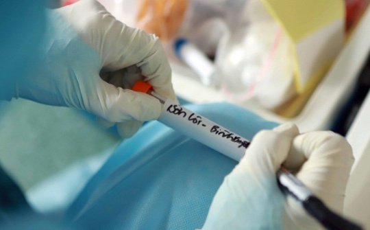 Các địa chỉ ở Việt Nam có thể xét nghiệm COVID-19