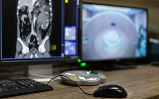 Trung Quốc phát minh ra công nghệ AI chỉ mất 20 giây để chẩn đoán bệnh nhân mắc Covid-19