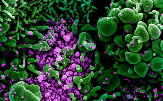 Ảnh chụp nCoV 'giết chết' tế bào người