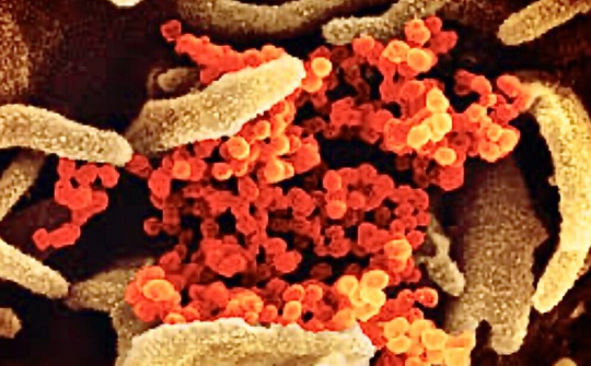 Đầu tư nghiên cứu các virus nguy hiểm: Nên hay không?