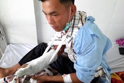 Kon Tum: Trong lúc tuần tra đêm, một nhân viên bảo vệ rừng bị chém trọng thương