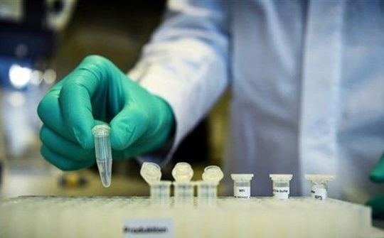 Phát triển bộ xét nghiệm khả năng miễn dịch đối với COVID-19