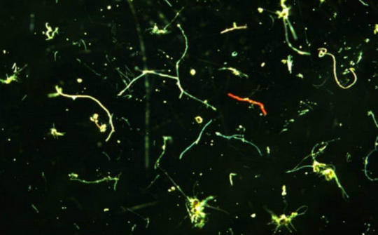 Phát hiện hạt vi nhựa với số lượng lớn dưới đáy biển