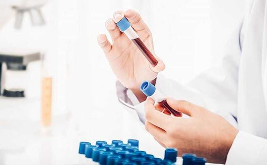 Lào Cai: 4 trường hợp về từ tỉnh Bình Dương có kết quả dương tính sau 5 lần xét nghiệm