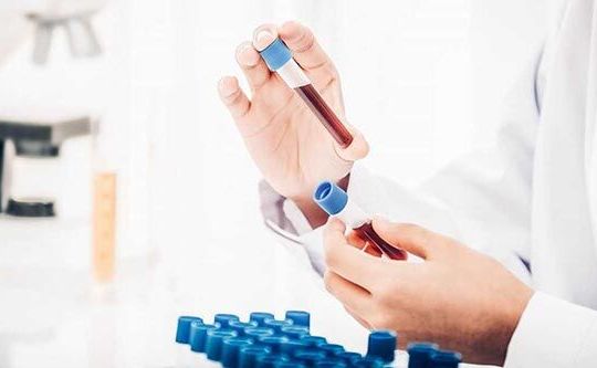 Lào Cai: 4 trường hợp về từ tỉnh Bình Dương có kết quả dương tính sau 5 lần xét nghiệm