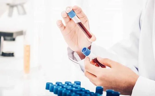 Lào Cai: 4 trường hợp về từ tỉnh Bình Dương có kết quả dương tính sau 5 lần xét nghiệm