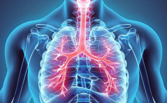 Các bệnh đường hô hấp thường gặp hiện nay