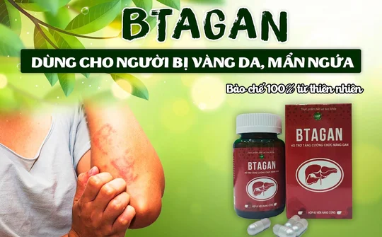 BTAGAN bảo vệ gan - Giải pháp cho người bị vàng da, mẩn ngứa