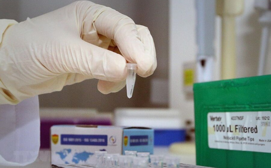 Loạn giá kit xét nghiệm Covid-19, Bộ Y tế yêu cầu địa phương vào cuộc