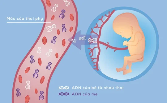 NIPT - Xét nghiệm sàng lọc trước sinh không xấm lấn