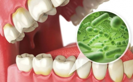 Mẹo nhỏ loại bỏ tình trạng hôi miệng nhờ sản phẩm Nutridentiz