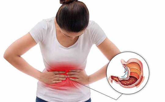 Đau dạ dày: Biết để phòng đúng cách