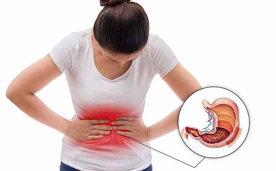 Đau dạ dày: Biết để phòng đúng cách