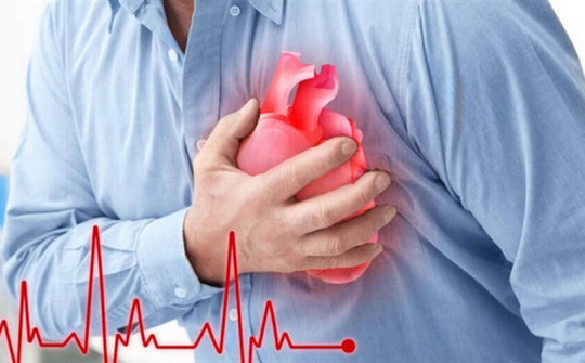 Tìm hiểu về bệnh nhồi máu cơ tim