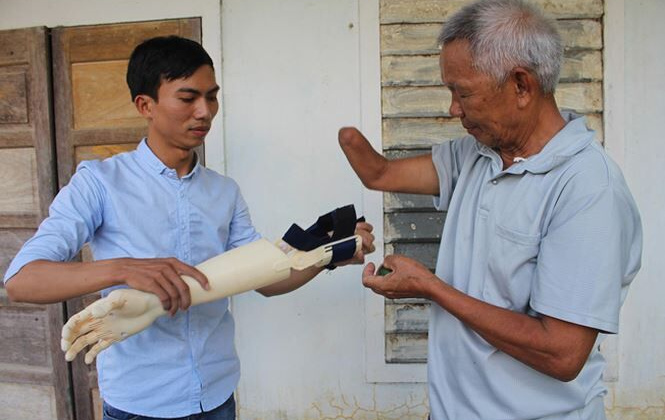 Sinh viên 9X chế tạo bàn tay robot giá rẻ cho người khuyết tật