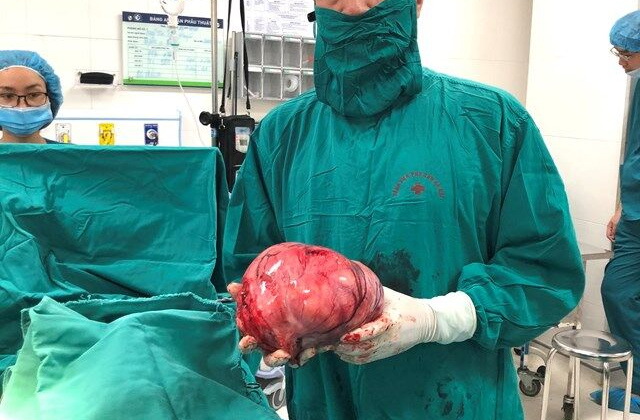Bệnh viện Phụ sản Hà Nội: Phẫu thuật thành công khối u xơ tử cung nặng 3730g