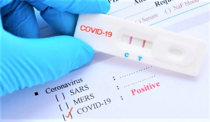 Hà Nội: Tự test nhanh dương tính Covid-19, người dân cần làm gì?