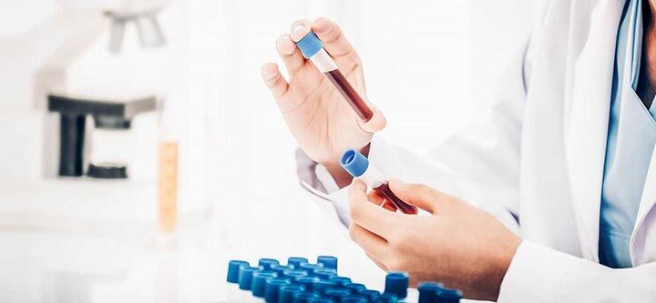 Lào Cai: 4 trường hợp về từ tỉnh Bình Dương có kết quả dương tính sau 5 lần xét nghiệm