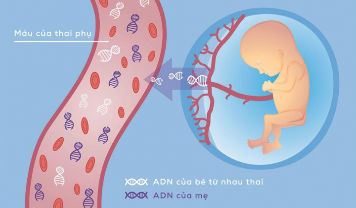 NIPT - Xét nghiệm sàng lọc trước sinh không xấm lấn