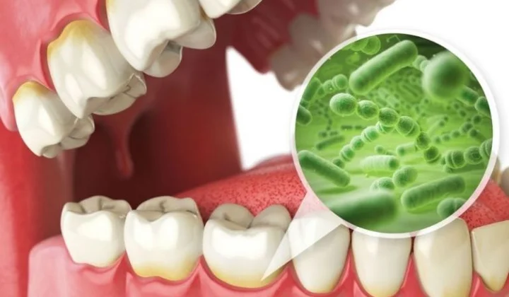 Mẹo nhỏ loại bỏ tình trạng hôi miệng nhờ sản phẩm Nutridentiz