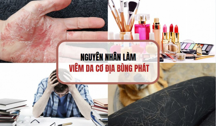 Eczestop - Giải pháp từ thiên nhiên hiệu quả cải thiện viêm da cơ địa