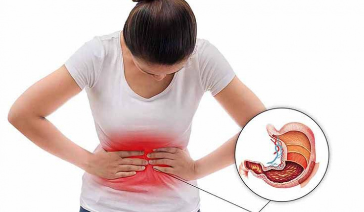 Đau dạ dày: Biết để phòng đúng cách