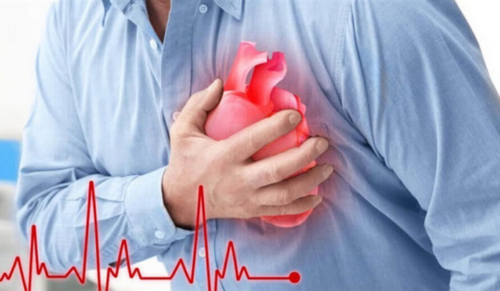 Tìm hiểu về bệnh nhồi máu cơ tim