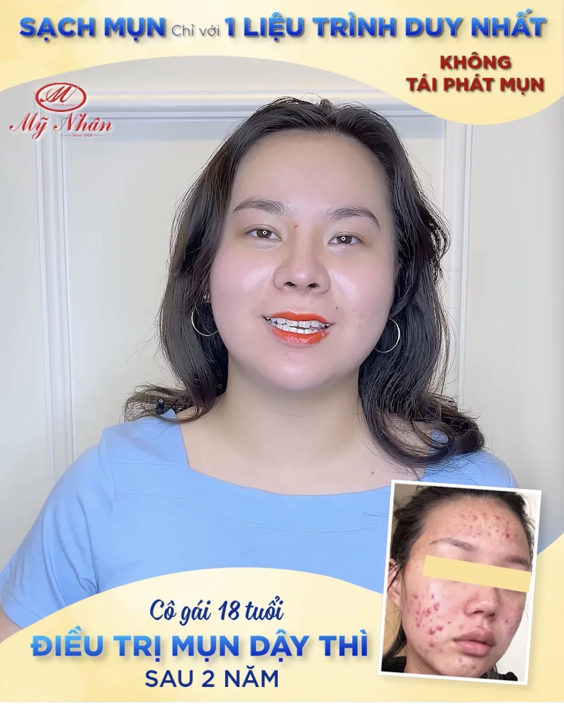 Nam Phương_21 tuổi, du học sinh Mỹ