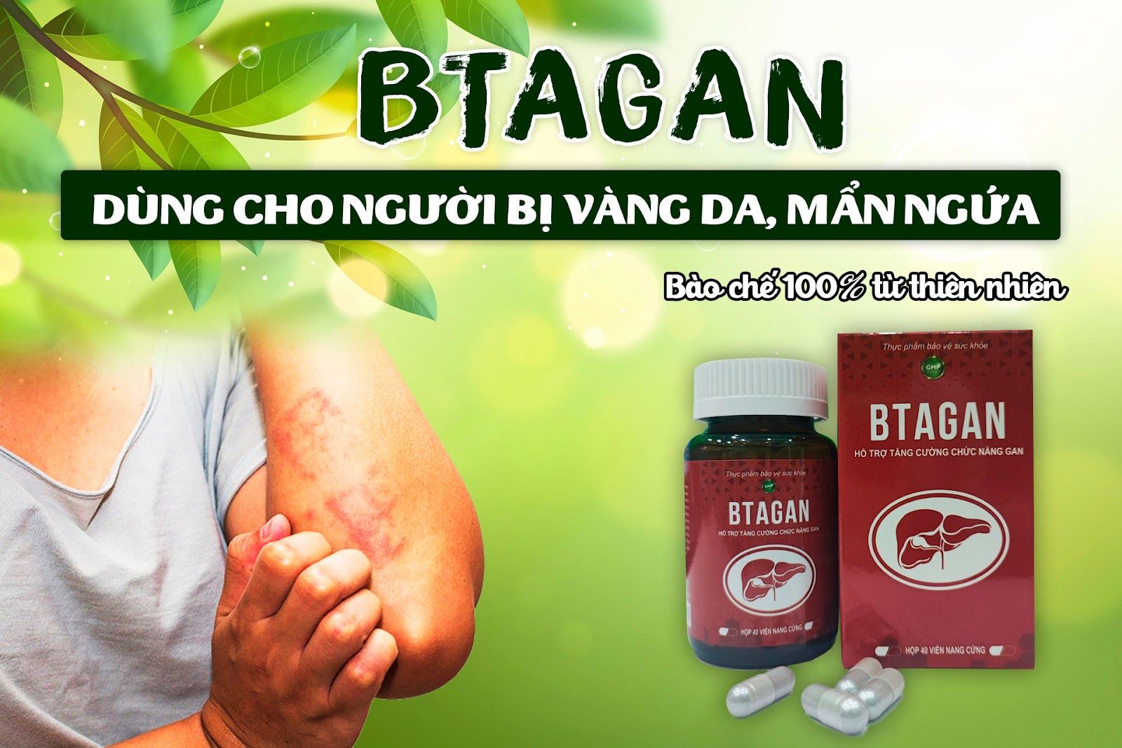 BTAGAN-dung-cho-nguoi-bi-vang-da-man-ngua